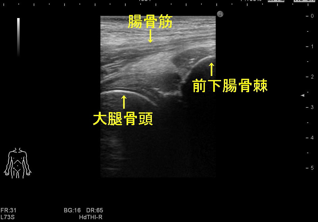 股関節２変更