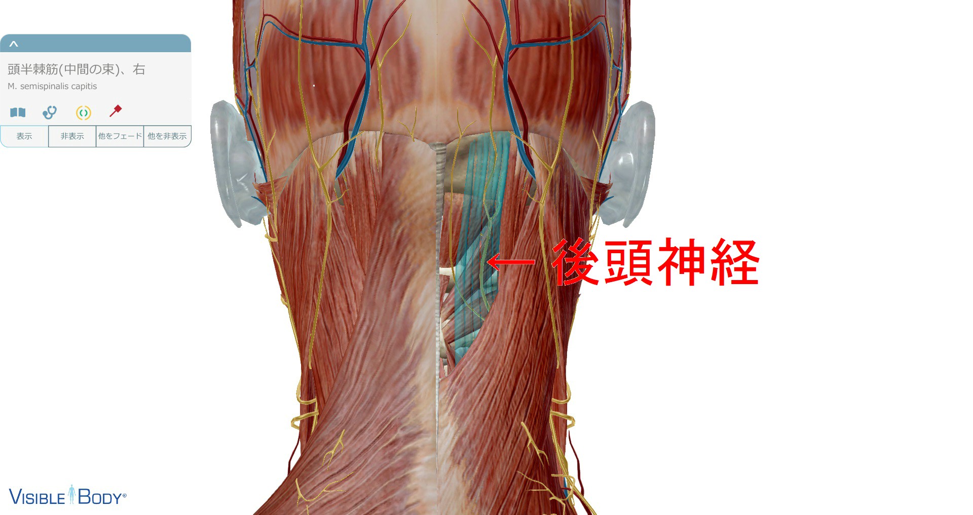 後頭神経痛で避けるべき運動