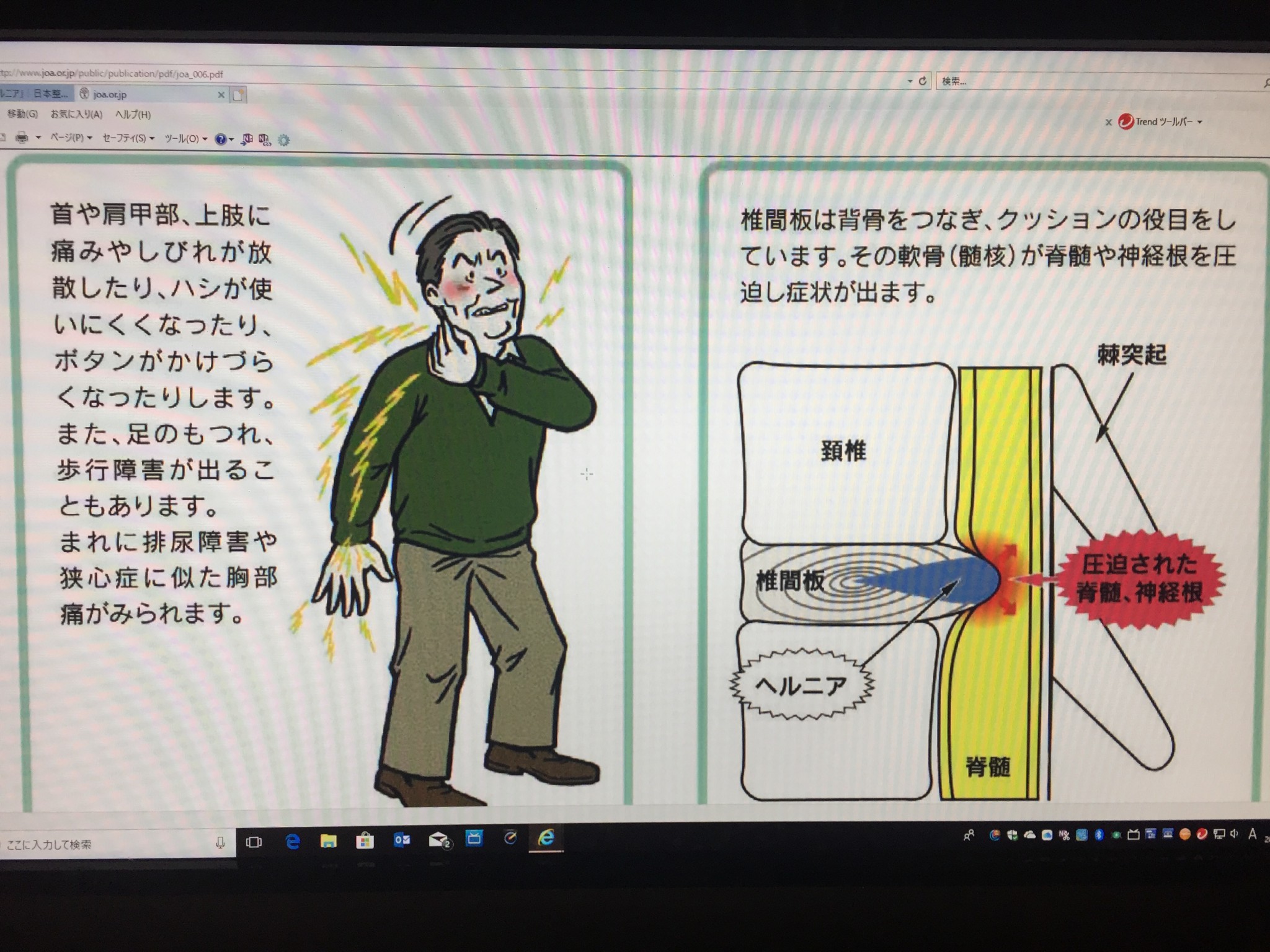 頚椎椎間板ヘルニア 愛知県岡崎市 整形外科 リウマチ科 エコーガイド下筋膜リリース ませぎ整形外科