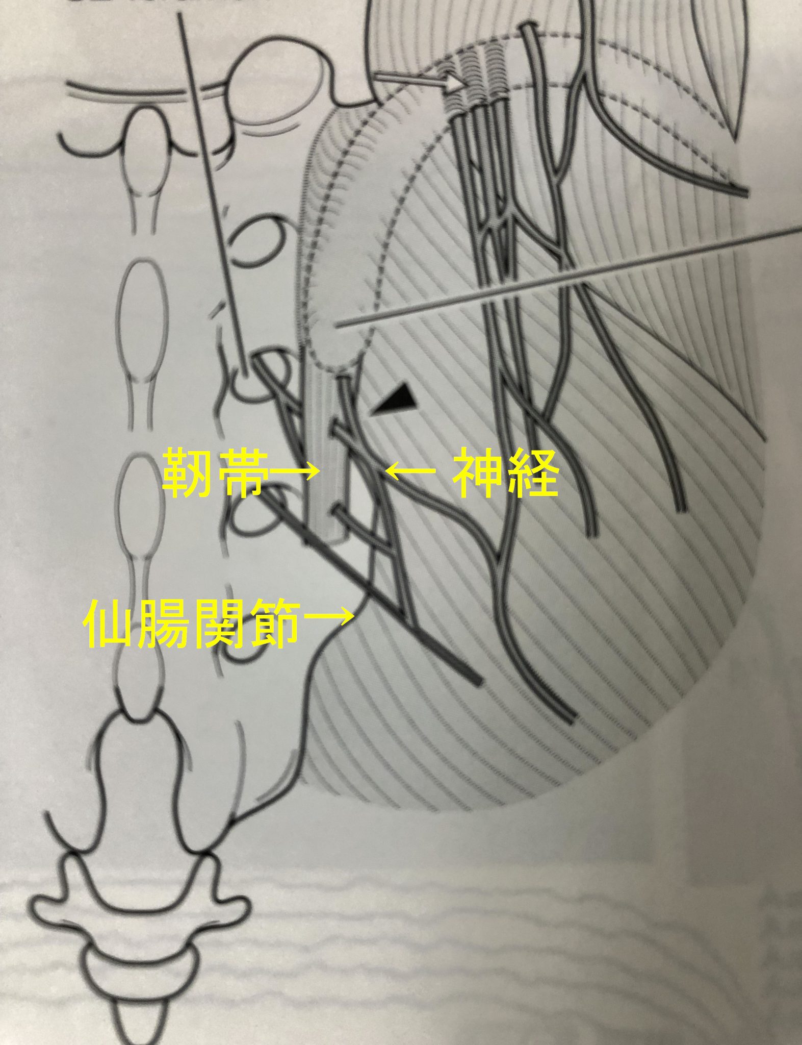 仙腸関節性腰痛 愛知県岡崎市 整形外科 リウマチ科 エコーガイド下筋膜リリース ませぎ整形外科