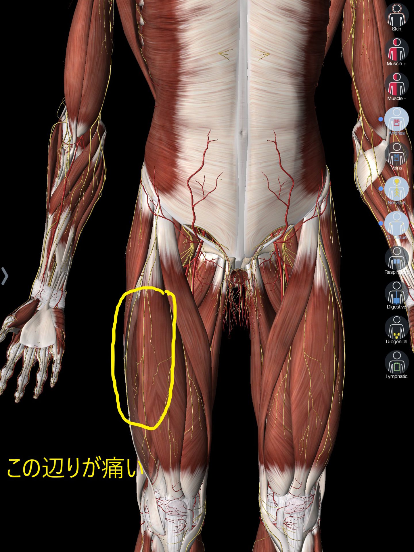 大腿部 もも の痛み 愛知県岡崎市 整形外科 リウマチ科 エコー